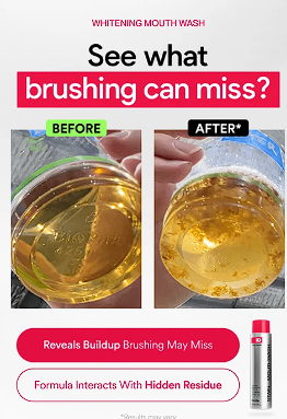 iD Stain Whitening Mouthwash Best Seller